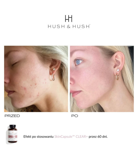 HUSH&HUSH Skin Capsule Clear+ Czysta cera 60 kaps.