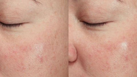 Dermalogica Magnetic Afterglow Cleanser Kremowy produkt oczyszczający 295 ml