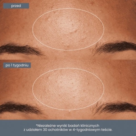 Dermalogica Daily Microfoliant + Daily Microfoliant Refill ZESTAW