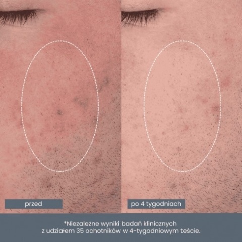 Dermalogica Daily Microfoliant + Daily Microfoliant Refill ZESTAW